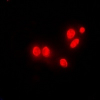 DNAJB6 Rabbit Polyclonal Antibody