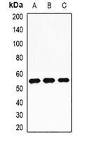 TdT Antibody