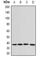 EEF1D Rabbit Polyclonal Antibody