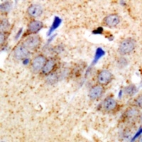 EEF1D Rabbit Polyclonal Antibody