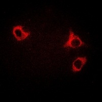 GCN2 Rabbit Polyclonal Antibody