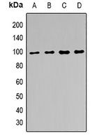 EZH2 Rabbit Polyclonal Antibody