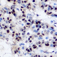 EZH2 Rabbit Polyclonal Antibody