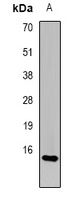 FABP2 Rabbit Polyclonal Antibody