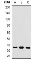 GAS2 Rabbit Polyclonal Antibody