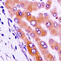 GAS2 Rabbit Polyclonal Antibody