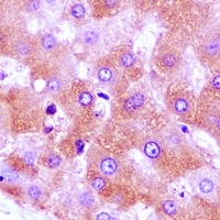 GNA11 Rabbit Polyclonal Antibody
