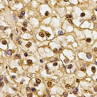 CSN1 Rabbit Polyclonal Antibody