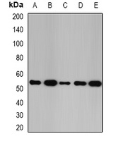 Glutathione Synthetase Rabbit Polyclonal Antibody