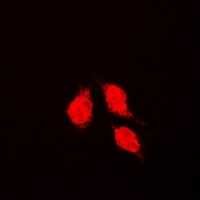 Glutathione Synthetase Rabbit Polyclonal Antibody