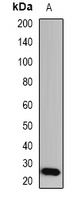GSTA1 Rabbit Polyclonal Antibody