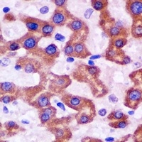 HAPLN1 Rabbit Polyclonal Antibody