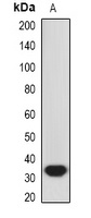 HO-1 Rabbit Polyclonal Antibody