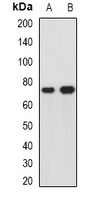 hnRNP R Rabbit Polyclonal Antibody