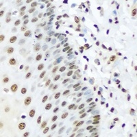 hnRNP R Rabbit Polyclonal Antibody