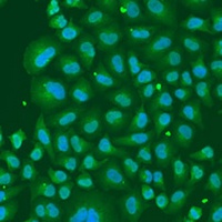 hnRNP R Rabbit Polyclonal Antibody