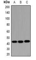 HSD17B2 Rabbit Polyclonal Antibody