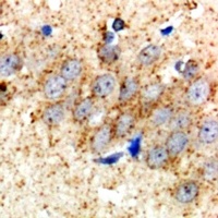 HSD17B2 Rabbit Polyclonal Antibody