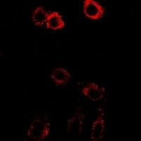 HSD17B2 Rabbit Polyclonal Antibody