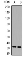 HUS1 Rabbit Polyclonal Antibody