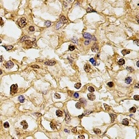 HUS1 Rabbit Polyclonal Antibody