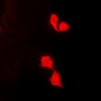 HUS1 Rabbit Polyclonal Antibody