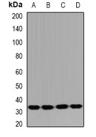HUS1B Rabbit Polyclonal Antibody