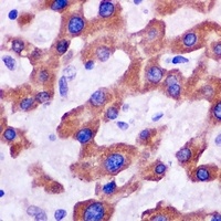 IFIT3 Rabbit Polyclonal Antibody