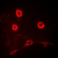 CD212 Antibody