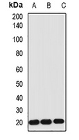 IL-1RA Antibody