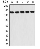 RANBP5 Rabbit Polyclonal Antibody
