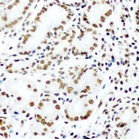 KLF4 Rabbit Polyclonal Antibody
