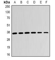LDHB Rabbit Polyclonal Antibody