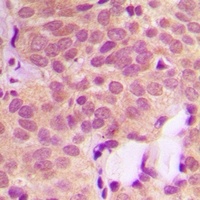 LDHB Rabbit Polyclonal Antibody
