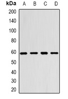 Monoamine Oxidase B Antibody