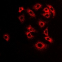 Monoamine Oxidase B Antibody