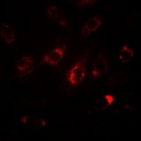 LC3A/B Rabbit Polyclonal Antibody