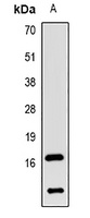 LC3B Rabbit Polyclonal Antibody