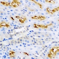 LC3B Rabbit Polyclonal Antibody