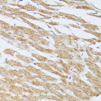 MKK5 Rabbit Polyclonal Antibody