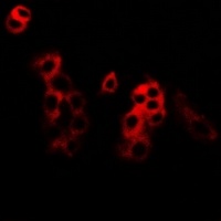 MKK5 Rabbit Polyclonal Antibody