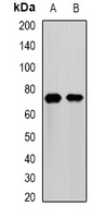 MMP25 Rabbit Polyclonal Antibody