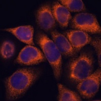 MMP25 Rabbit Polyclonal Antibody