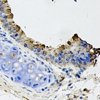 GDF8 Rabbit Polyclonal Antibody