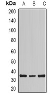 Calsarcin 1 Rabbit Polyclonal Antibody