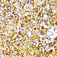 Visfatin Rabbit Polyclonal Antibody