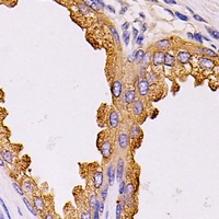 NCK2 Rabbit Polyclonal Antibody