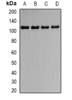 IL-31RB Rabbit Polyclonal Antibody