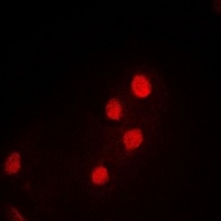 PDCD5 Antibody
