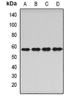 PNKP Rabbit Polyclonal Antibody